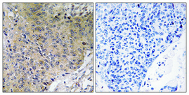 IHC - NF2 Polyclonal Antibody AP71263